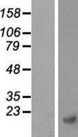 Novus Biologicals&trade;&nbsp;ICAT/CTNNBIP1 Overexpression Lysate