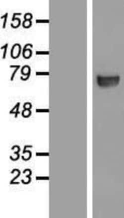 Novus Biologicals&trade;&nbsp;CTP synthase Overexpression Lysate