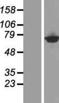 Novus Biologicals&trade;&nbsp;CTPS2 Overexpression Lysate