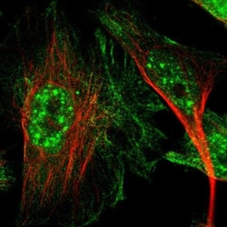 CTR2 Antibody, Novus Biologicals:Antibodies:Primary Antibodies