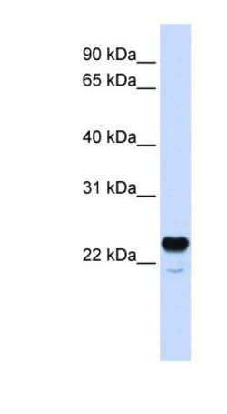 C1qTNF1/CTRP1 Antibody, Novus Biologicals 100 &mu;L | Buy Online | Novus Biologicals | Fisher Scientific