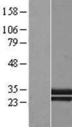 Novus Biologicals&trade;&nbsp;C1qTNF1/CTRP1 Overexpression Lysate
