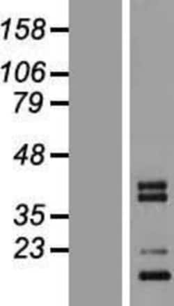 Novus Biologicals&trade;&nbsp;C1qTNF3/CORS26/CTRP3 Overexpression Lysate