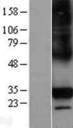 R&D Systems&trade;&nbsp;CTRP6 Overexpression Lysate