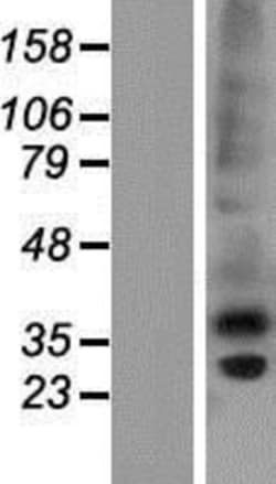 Novus Biologicals™ CTRP6 Overexpression Lysate