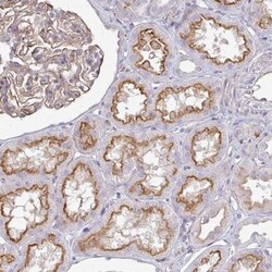 CTRP7 Antibody, Novus Biologicals 25 &mu;L, Unlabeled:Antibodies, Polyclonal