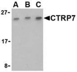 CTRP7 Antibody - BSA Free, Novus Biologicals 0.1mg; Unlabeled:Antibodies,