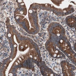 CTTNBP2NL Antibody, Novus Biologicals 25 &mu;L; Unlabeled:Antibodies, Polyclonal