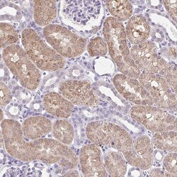 CTU1 Antibody, Novus Biologicals:Antibodies:Primary Antibodies