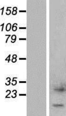 Novus Biologicals&trade;&nbsp;CTXN1 Overexpression Lysate