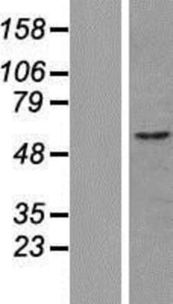 Novus Biologicals&trade;&nbsp;CUEDC1 Overexpression Lysate