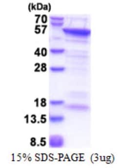 Novus Biologicals&trade;&nbsp;Recombinant Human CUEDC1 His Protein