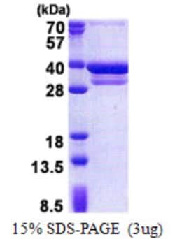Novus Biologicals&trade;&nbsp;Recombinant Human CUEDC2 His Protein
