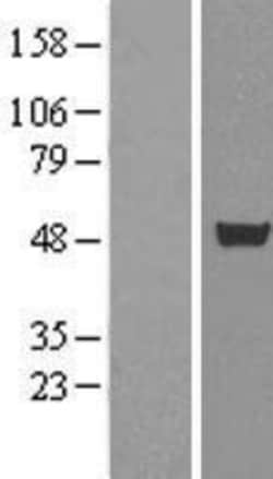 Novus Biologicals&trade;&nbsp;CUGBP1/CELF1 Overexpression Lysate