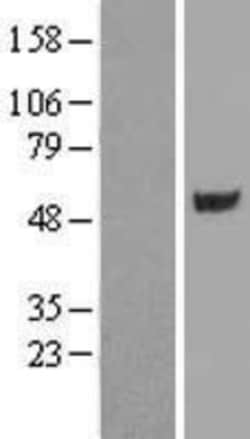 Novus Biologicals&trade;&nbsp;CUGBP1/CELF1 Overexpression Lysate