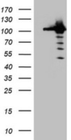 CUL4B Antibody (OTI1C4), Novus Biologicals 0.1 mL | Buy Online | Novus Biologicals | Fisher Scientific