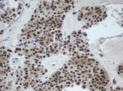 CUL4B Antibody (OTI1C4), Novus Biologicals 0.1 mL | Buy Online | Novus Biologicals | Fisher Scientific