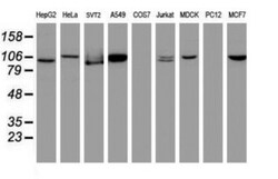 CUL4B Antibody (OTI1C4), Novus Biologicals 0.1 mL | Buy Online | Novus Biologicals | Fisher Scientific
