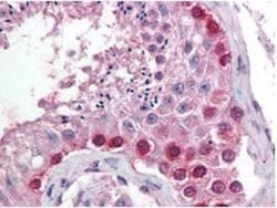 Cullin 4a Antibody - N-terminal, Novus Biologicals 0.1mL; Unlabeled:Antibodies,
