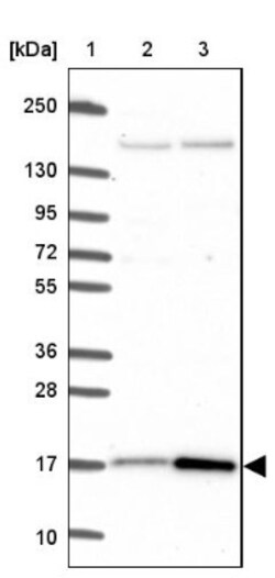 CutA Antibody, Novus Biologicals 0.1mL; Unlabeled:Antibodies, Polyclonal