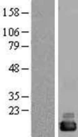 Novus Biologicals&trade;&nbsp;CutA Overexpression Lysate