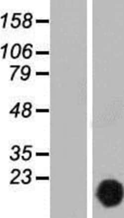 Novus Biologicals CutA Overexpression Lysate 0.1 mg | Buy Online | Novus Biologicals&trade; | Fisher Scientific