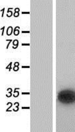 Novus Biologicals&trade;&nbsp;CUTC Overexpression Lysate
