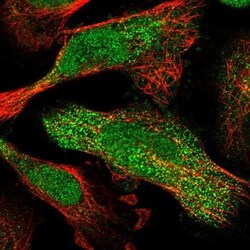 CUTC Antibody, Novus Biologicals 25 &mu;L; Unlabeled:Antibodies, Polyclonal
