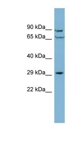 CUTC Antibody, Novus Biologicals:Antibodies:Primary Antibodies
