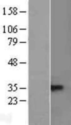 Novus Biologicals&trade;&nbsp;TACI/TNFRSF13B/CVID Overexpression Lysate