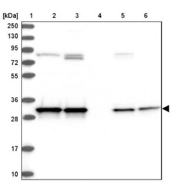 CWC15 Antibody, Novus Biologicals 0.1mL; Unlabeled:Antibodies, Polyclonal