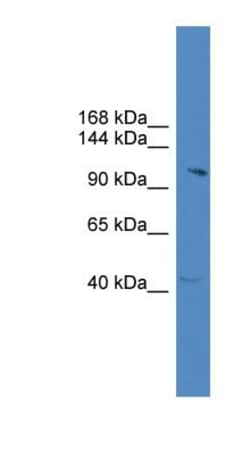 CWC22 Antibody, Novus Biologicals 100&mu;L; Unlabeled:Antibodies, Polyclonal
