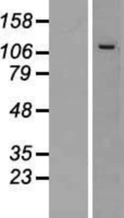 Novus Biologicals&trade;&nbsp;CWC22 Overexpression Lysate