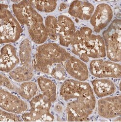 CWH43 Antibody, Novus Biologicals 0.1mL; Unlabeled:Antibodies, Polyclonal
