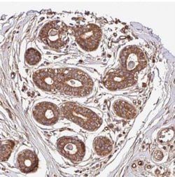CWH43 Antibody, Novus Biologicals 25 &mu;L, Unlabeled:Antibodies, Polyclonal