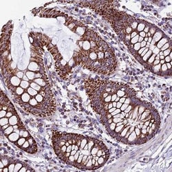 CX3CL1/Fractalkine Antibody, Novus Biologicals 0.1 mL | Buy Online | Novus Biologicals | Fisher Scientific