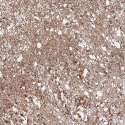 CX3CR1 Antibody, Novus Biologicals:Antibodies:Primary Antibodies