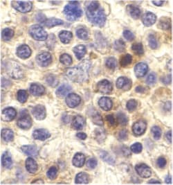CX3CR1 Antibody - BSA Free, Novus Biologicals 0.1mg; Unlabeled:Antibodies,