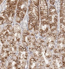 CXADR Antibody, Novus Biologicals 0.1mL; Unlabeled:Antibodies, Polyclonal