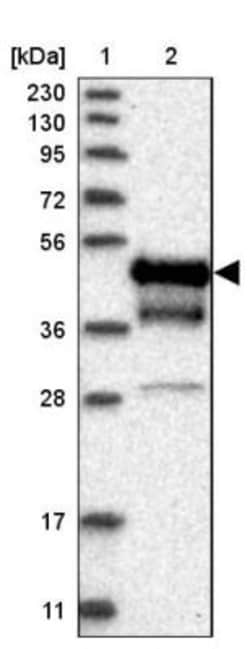 CXADR Antibody, Novus Biologicals 0.1mL; Unlabeled:Antibodies, Polyclonal
