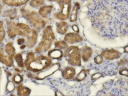 CXCL14/BRAK Antibody, Novus Biologicals 0.1mL; Unlabeled:Antibodies, Polyclonal