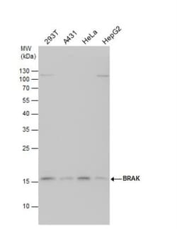 CXCL14/BRAK Antibody, Novus Biologicals 0.1mL; Unlabeled:Antibodies, Polyclonal