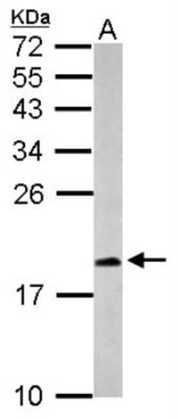 CXCL14/BRAK Antibody, Novus Biologicals 0.1mL; Unlabeled:Antibodies, Polyclonal