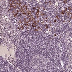 CXCL16 Antibody, Novus Biologicals 0.1mL; Unlabeled:Antibodies, Polyclonal