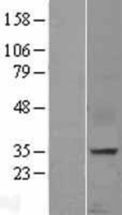 Novus Biologicals&trade;&nbsp;CXCL16 Overexpression Lysate
