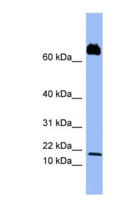 CXCL4L1 Antibody, Novus Biologicals 100 &mu;L | Buy Online | Novus Biologicals | Fisher Scientific