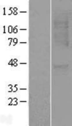 Novus Biologicals&trade;&nbsp;CXCR1/IL-8RA Overexpression Lysate