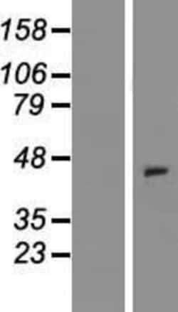 Novus Biologicals&trade;&nbsp;XCR1/CCXCR1 Overexpression Lysate