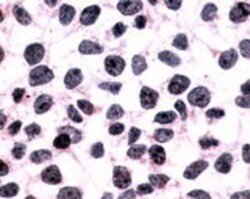 CXCR1/IL-8RA Antibody - BSA Free, Novus Biologicals 0.05 mL | Buy Online | Novus Biologicals | Fisher Scientific