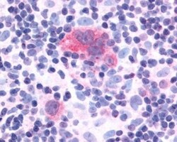 CXCR1/IL-8RA Antibody - BSA Free, Novus Biologicals 0.05 mL | Buy Online | Novus Biologicals | Fisher Scientific